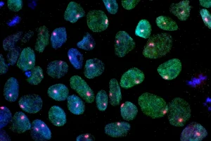 Induced Pluripotent Stem Cells: History and A Look Back